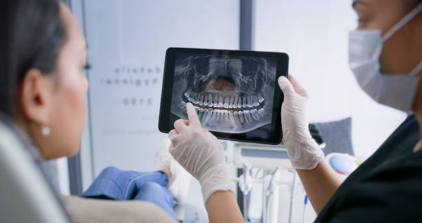 Licensed Teeth Whitening service in Willis, TX - Smile Center Dentistry
